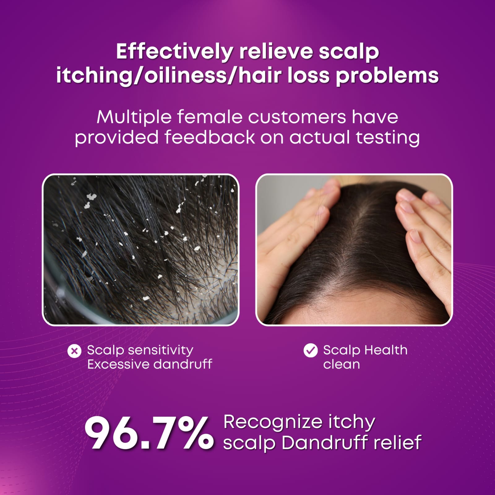 Scalp Massager Brush (Red) – فرشاة تدليك فروة الرأس (حمراء)